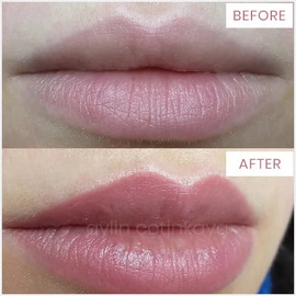 Permanent Lips Colour